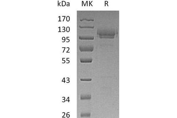 CADM1 Protein (Fc Tag)