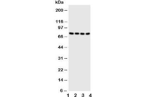 Western blot testing of PAK6 antibody and Lane 1:  HeLa;  2: 293T;  3: Raji;  4: COLO320 cell lysate (PAK6 antibody  (N-Term))