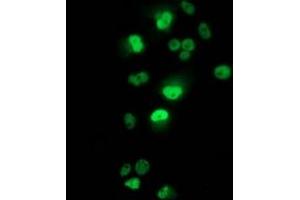 Anti-TP53 mouse monoclonal antibody (ABIN2454551) immunofluorescent staining of COS7 cells transiently transfected by pCMV6-ENTRY TP53 (RC200003). (p53 antibody)