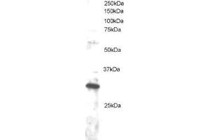 ABIN2562232 staining (1µg/ml) of Jurkat lysate (RIPA buffer, 30µg total protein per lane). (DKK4 antibody  (C-Term))