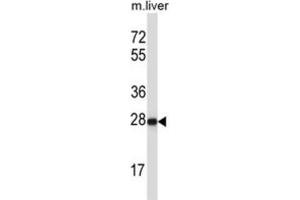 Western Blotting (WB) image for anti-Helt BHLH Transcription Factor (HELT) antibody (ABIN2997439) (HELT antibody)