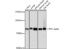 Western blot analysis of extracts of various cell lines, using PKC alpha pAb (ABIN6128460, ABIN6135858, ABIN6135859 and ABIN7101370) at 1:1000 dilution. (PKC alpha antibody)