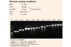 Image no. 1 for TransStart® TopTaq DNA Polymerase (ABIN5519568)