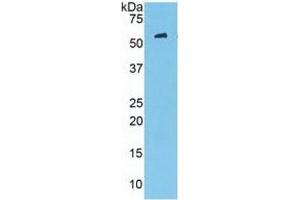 Western Blotting (WB) image for Mannose-Binding Lectin (Protein C) 2, Soluble (MBL2) ELISA Kit (ABIN6574278)