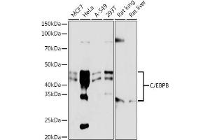 Western blot analysis of extracts of various cell lines, using C/EBPB antibody (ABIN7266158) at 1:1000 dilution. (CEBPB antibody)