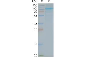 Human -Nanodisc, Flag Tag on SDS-PAGE (TLR5 Protein)