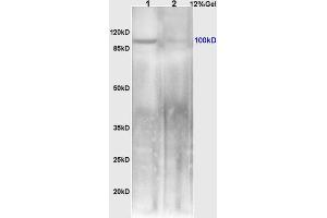 L1 mouse small intestine lysates L2 rat brain lysates probed with Anti NFkB Inducing Kinase NIK Polyclonal Antibody, Unconjugated (ABIN724520) at 1:200 overnight at 4 °C. (MAP3K14 antibody  (AA 901-947))