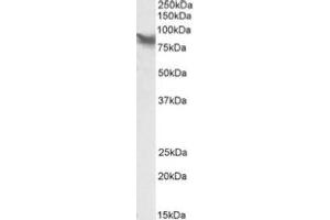 Image no. 1 for anti-Lipoma-preferred partner (LPP) (Internal Region) antibody (ABIN487982) (LPP 抗体  (Internal Region))