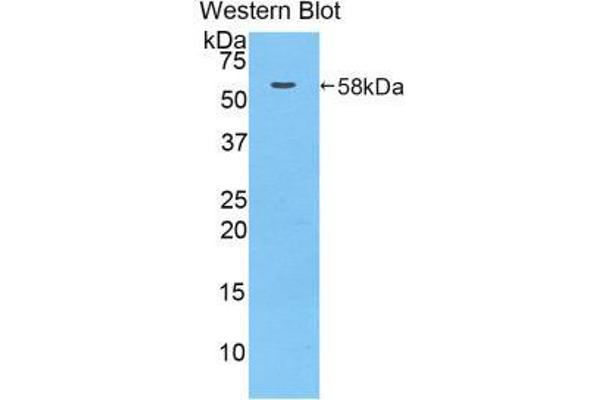 MACC1 antibody  (AA 522-784)