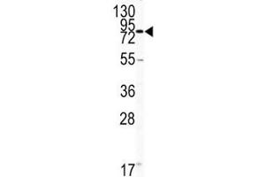 Western blot analysis of CD31 antibody and HL-60 lysate. (CD31 antibody  (AA 690-718))