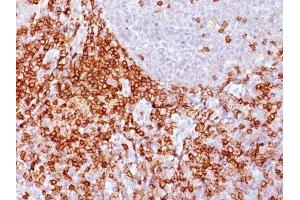 Image no. 1 for anti-Sialophorin (SPN) antibody (ABIN6159418) (CD43 antibody)