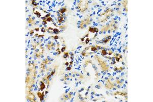 Immunohistochemistry of paraffin-embedded rat kidney using GABARAP antibody (ABIN6291799) at dilution of 1:100 (40x lens). (GABARAP antibody)