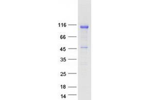 NOLC1 Protein (Myc-DYKDDDDK Tag)