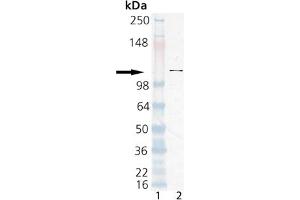 Western Blot Analysis of the Poly(ADP-ribose) polymerase, pAb . (PARP1 antibody  (AA 509-524))