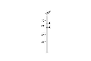 Western blot analysis of lysate from Hela cell line, using FUT8 Antibody at 1:1000 at each lane. (FUT8 antibody  (AA 329-357))