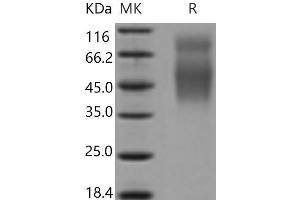 Western Blotting (WB) image for CD86 (CD86) (Active) protein (His tag) (ABIN7321237) (CD86 Protein (CD86) (His tag))