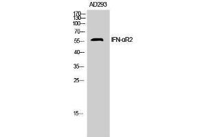 Western Blotting (WB) image for anti-IFN-AlphaR2 (N-Term) antibody (ABIN3181026) (IFN-AlphaR2 (N-Term) antibody)