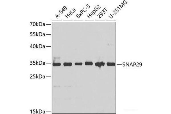 SNAP29 antibody