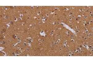 Immunohistochemistry of paraffin-embedded Human brain tissue using MAGEB10 Polyclonal Antibody at dilution 1:60 (MAGEB10 antibody)