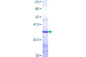 Image no. 1 for Phosphofructokinase, Liver (PFKL) (AA 441-540) protein (GST tag) (ABIN1314747) (PFKL Protein (AA 441-540) (GST tag))