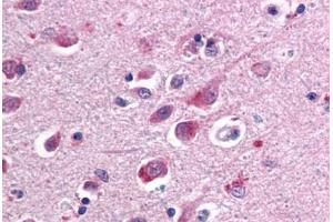 Human Brain, Cortex (formalin-fixed, paraffin-embedded) stained with SARM1 antibody ABIN461750 at 10 ug/ml followed by biotinylated anti-mouse IgG secondary antibody ABIN481714, alkaline phosphatase-streptavidin and chromogen. (SARM1 antibody  (AA 93-292))