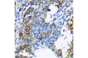 Immunohistochemistry of paraffin-embedded Rat ovary using PTCH1 antibody (ABIN1682368, ABIN1682367, ABIN3015342, ABIN3015343 and ABIN6213997) at dilution of 1:100 (40x lens). (Patched 1 antibody  (AA 1214-1312))
