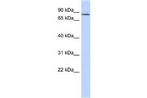 APBB2 antibody used at 1 ug/ml to detect target protein. (APBB2 antibody  (Middle Region))