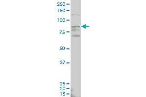 ALDH18A1 monoclonal antibody (M01), clone 2B5 Western Blot analysis of ALDH18A1 expression in MCF-7 . (P5CS antibody  (AA 696-795))