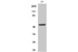 Western Blotting (WB) image for anti-Matrix Metallopeptidase 14 (Membrane-inserted) (MMP14) (cleaved), (Tyr112) antibody (ABIN3181813) (MMP14 antibody  (cleaved, Tyr112))