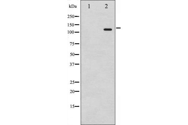 Retinoblastoma 1 antibody  (pSer795)