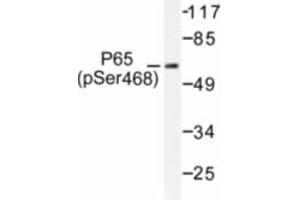 Image no. 1 for anti-Nuclear Factor-kB p65 (NFkBP65) (pSer468) antibody (ABIN318083) (NF-kB p65 antibody  (pSer468))