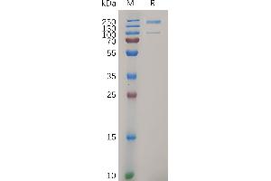 ITGA2 Protein (AA 30-1132) (His tag)