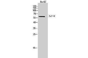 Western Blotting (WB) image for anti-Solute Carrier Family 30 (Zinc Transporter), Member 9 (SLC30A9) (Internal Region) antibody (ABIN6281324) (SLC30A9 antibody  (Internal Region))