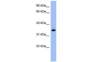 GAPDH antibody used at 1 ug/ml to detect target protein. (GAPDH antibody  (Middle Region))