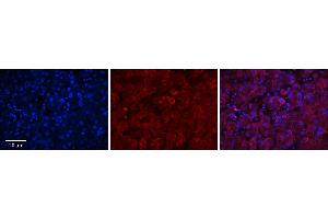 Rabbit Anti-GGCX Antibody      Formalin Fixed Paraffin Embedded Tissue: Human Adult Liver   Observed Staining: Cytoplasm in hepatocytes, strong signal, wide tissue distribution  Primary Antibody Concentration: 1:100  Secondary Antibody: Donkey anti-Rabbit-Cy3  Secondary Antibody Concentration: 1:200  Magnification: 20X  Exposure Time: 0. (GGCX antibody  (Middle Region))