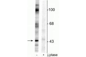 Western blot of rat testes lysate showing specific immunolabeling of the ~46 kDa EphrinB phosphorylated at Tyr317 in the first lane (-). (EPH Receptor B2 antibody  (pTyr317))