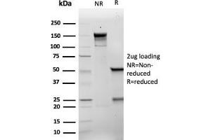 SDS-PAGE Analysis Purified p21 Recombinant Mouse Monoclonal Antibody (rCIP1/6907). (Recombinant p21 antibody  (AA 1-100))