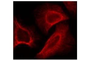 Image no. 2 for anti-Ribosomal Protein S6 Kinase, 70kDa, Polypeptide 1 (RPS6KB1) (pSer424) antibody (ABIN197052) (RPS6KB1 antibody  (pSer424))