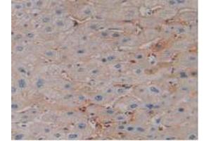 DAB staining on IHC-P; Samples: Human Liver Tissue (EPO antibody  (AA 28-193))