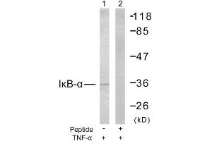 Western Blotting (WB) image for anti-Nuclear Factor of kappa Light Polypeptide Gene Enhancer in B-Cells Inhibitor, alpha (NFKBIA) (Ser32), (Ser36) antibody (ABIN1848116) (NFKBIA antibody  (Ser32, Ser36))