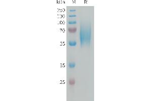 Human F Protein, His Tag on SDS-PAGE under reducing condition. (FGFR2 Protein (AA 22-374) (His tag))
