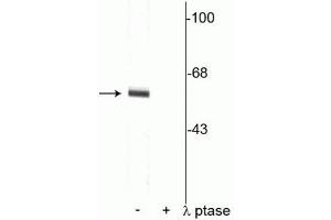 Western blot of rat cortical lysate showing specific immunolabeling of the ~62 kDa synaptotagmin phosphorylated at Thr202 in the first lane (-). (SYT1 antibody  (pThr202))