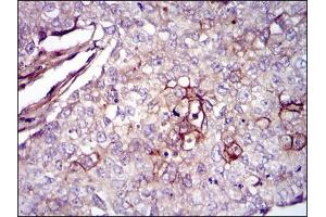 Immunohistochemistry (IHC) image for anti-Fibronectin 1 (FN1) antibody (ABIN969149)