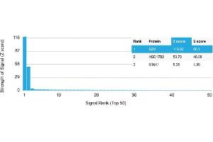 Analysis of Protein Array containing more than 19,000 full-length human proteins using Beta-2 Microglobulin Mouse Recombinant Monoclonal Antibody (rB2M/961). (Recombinant beta-2 Microglobulin antibody)