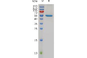 Human Protein, hFc Tag on SDS-PAGE under reducing condition. (FGF21 Protein (AA 29-209) (Fc Tag))