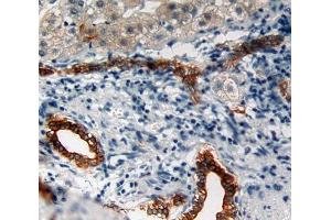 Used in DAB staining on fromalin fixed paraffin- embedded liver tissue (Cytokeratin 5 antibody  (AA 166-474))