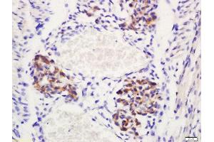 Formalin-fixed and paraffin embedded mouse emrbyo labeled with Rabbit Anti-Delta 4 Polyclonal Antibody, Unconjugated (ABIN761606) at 1:200 followed by conjugation to the secondary antibody and DAB staining (DLL4 antibody  (AA 551-650))