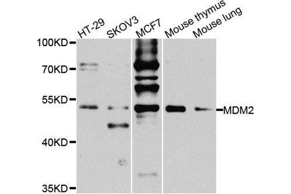 MDM2 antibody  (AA 130-230)