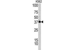 Western Blotting (WB) image for anti-Complement Factor H-Related 1 (CFHR1) antibody (ABIN3002714) (CFHR1 antibody)