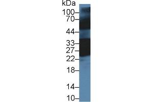Detection of CRYbB1 in Mouse Eye lysate using Polyclonal Antibody to Crystallin Beta B1 (CRYbB1) (CRYBB1 antibody  (AA 6-186))